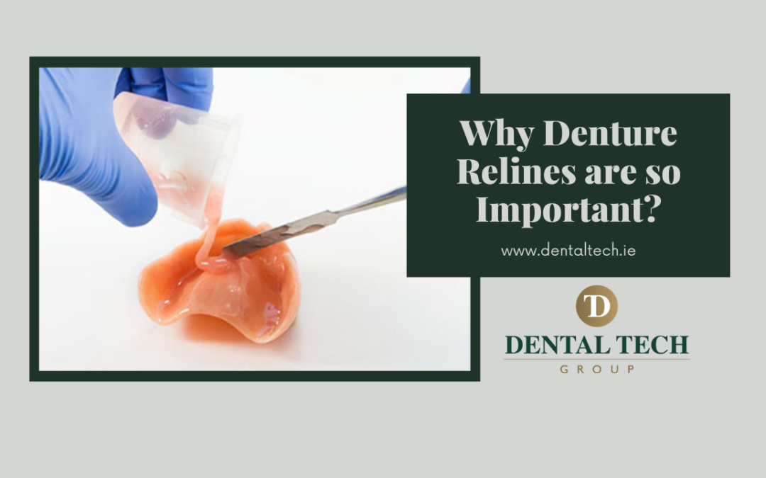 Why Denture Relines Are So Important?