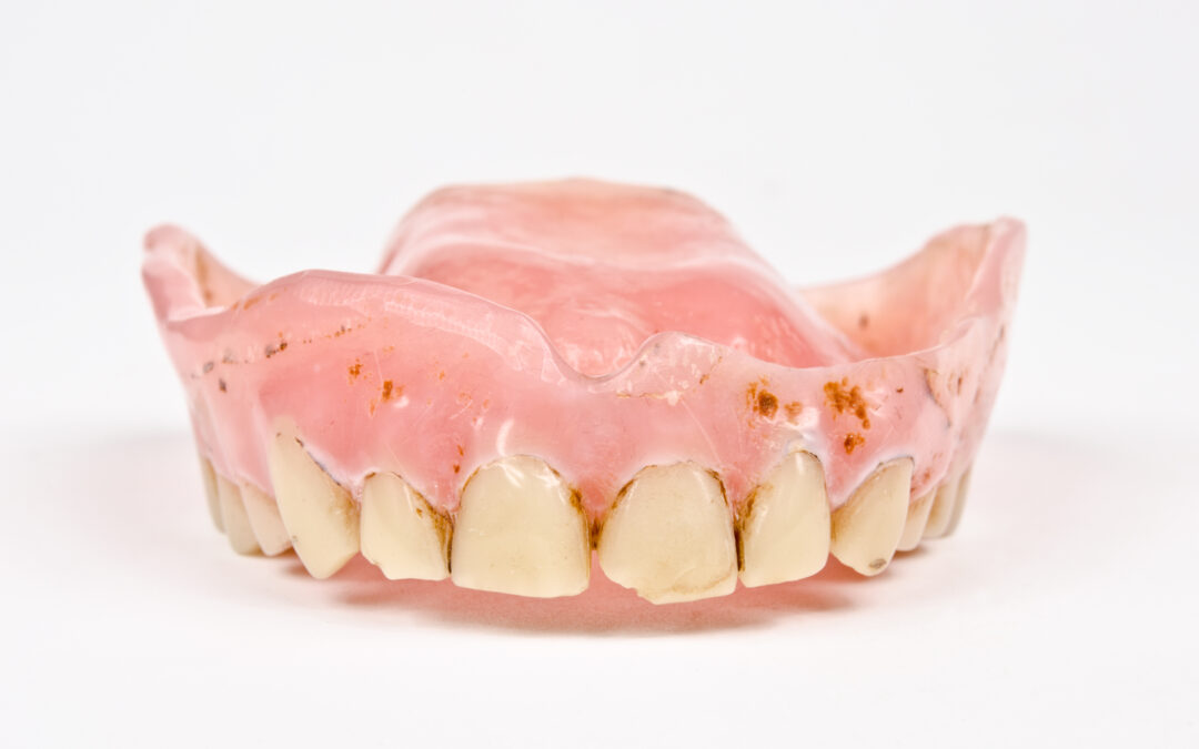 Old Dentures can have a Negative Impact on your Health!