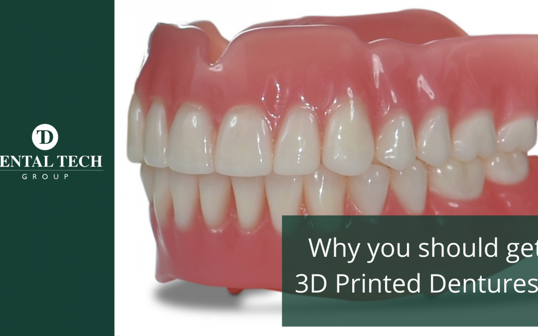 Why should you get 3D Printed Dentures?