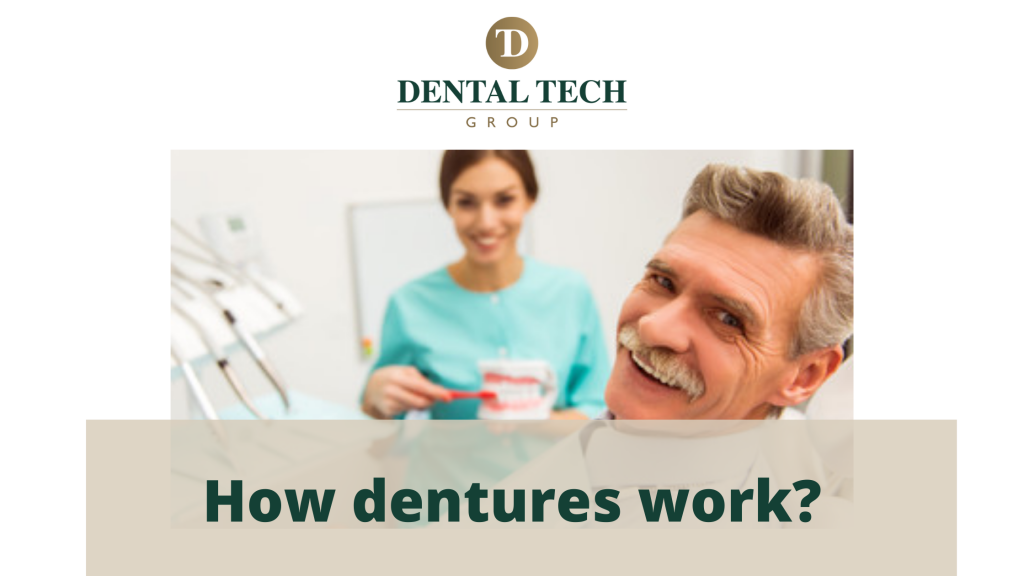 How dentures works?
