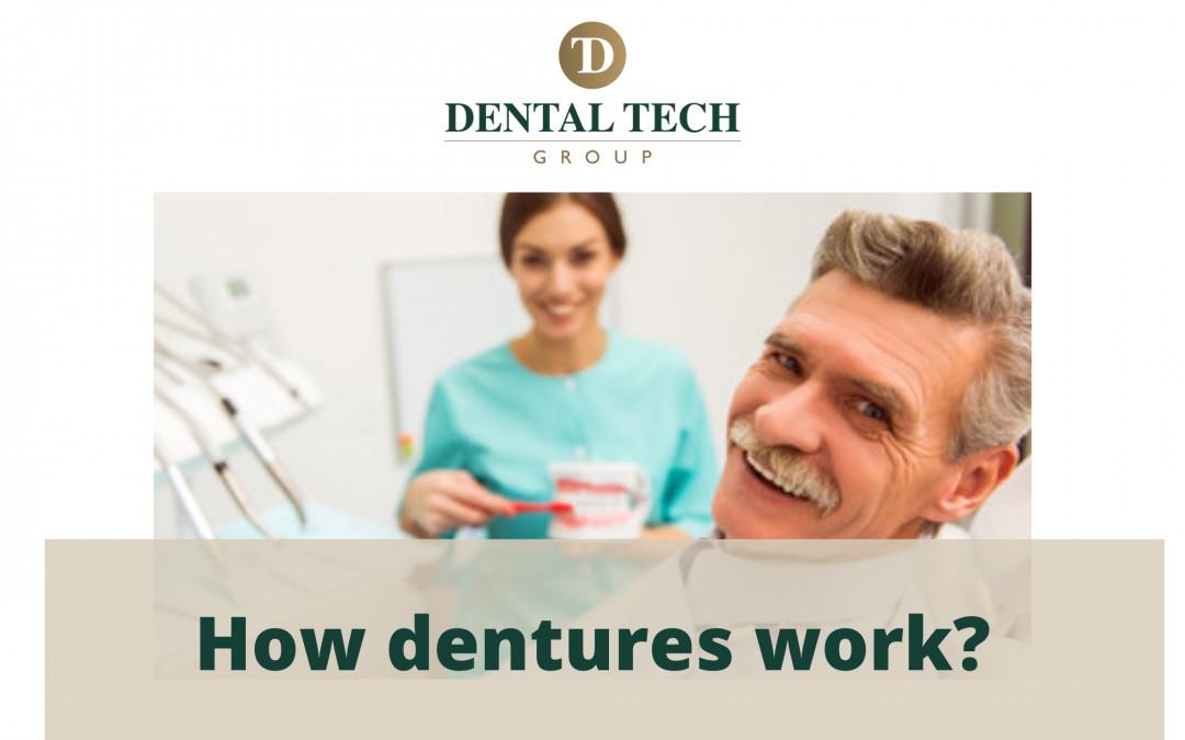 How dentures works?