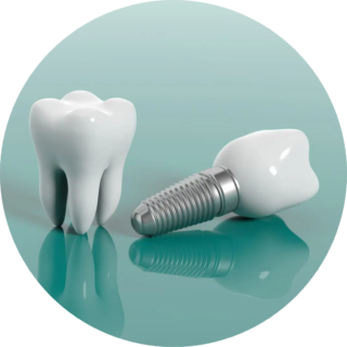 https://dentaltech.ie/wp-content/uploads/2024/09/image-1-1-dental-implant-modified-320x320.png