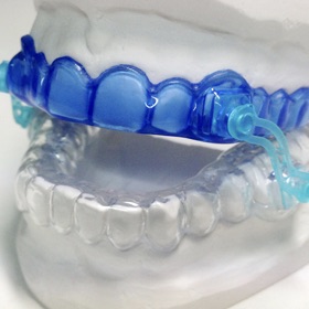 https://dentaltech.ie/wp-content/uploads/2025/03/AntiSnoringDevice.jpeg